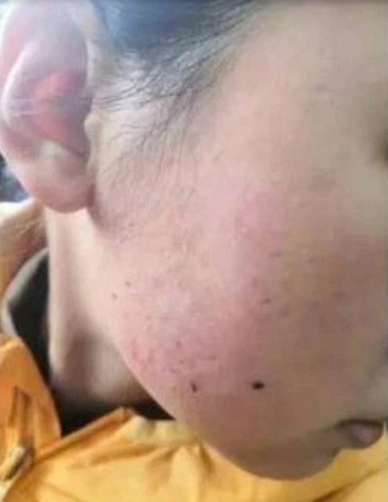 Học hành 'không đạt chuẩn của mẹ', bé gái 12 tuổi bị bạo hành dã man