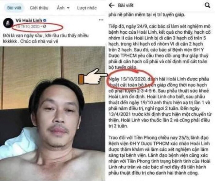 Lộ bản tường trình phẫu thuật của Hoài Linh: Thời gian hoàn toàn sai lệch với thông tin công bố trước đó? Ảnh 2