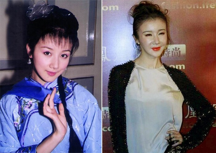 Trở thành thảm họa dao kéo, 5 sao Hoa ngữ lao dốc từ ngoại hình tới sự nghiệp Ảnh 8