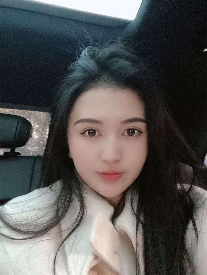 Hot girl 33 tuổi qua đời trong đau đớn sau 2 tháng hút mỡ, nâng ngực