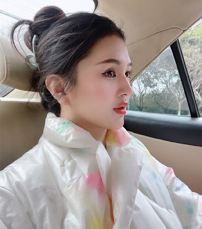 Hot girl 33 tuổi qua đời trong đau đớn sau 2 tháng hút mỡ, nâng ngực