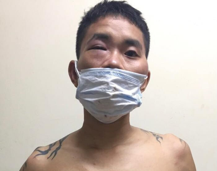 Nam thanh niên 'ngáo đá' không đeo khẩu trang, ra chốt túm tóc cán bộ đòi xe máy vi phạm Ảnh 1