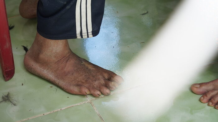 Người đàn ông bị xích suốt 30 năm: Từng là nỗi ám ảnh của nhiều người