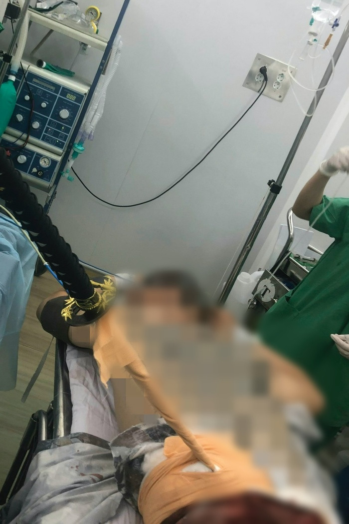 Cứu sống nam thanh niên nhập viện với thanh kiếm đâm xuyên thắt lưng