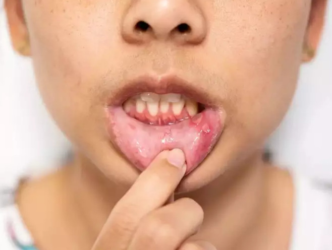 Những dấu hiệu ung thư nam giới thường bỏ qua