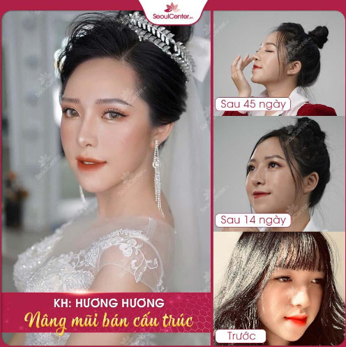 nang-mui-1-1652254958.PNG