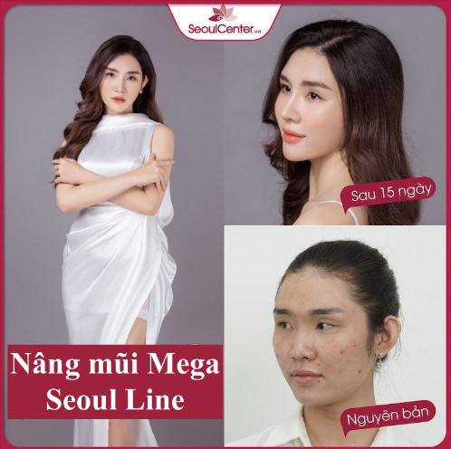 nang-mui-2-1652255002.PNG