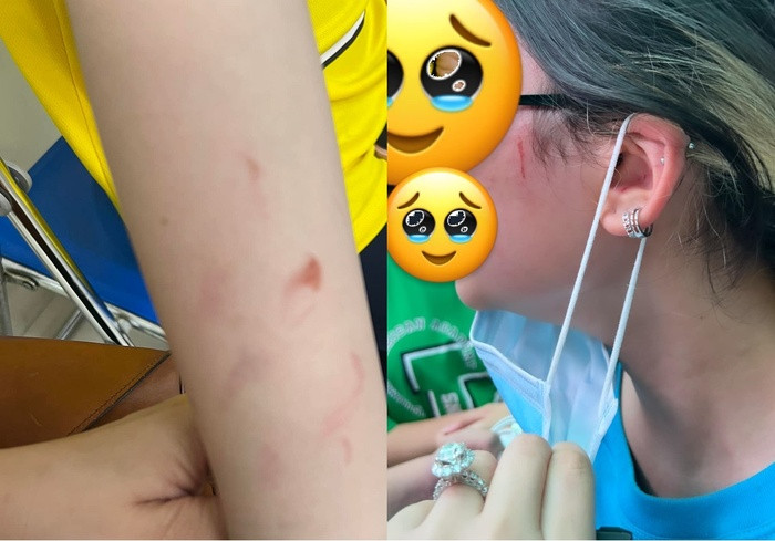 Vụ phụ huynh trường quốc tế tố con gái bị bạn học hành hung: Nhà trường thừa nhận xử lý chưa khéo léo