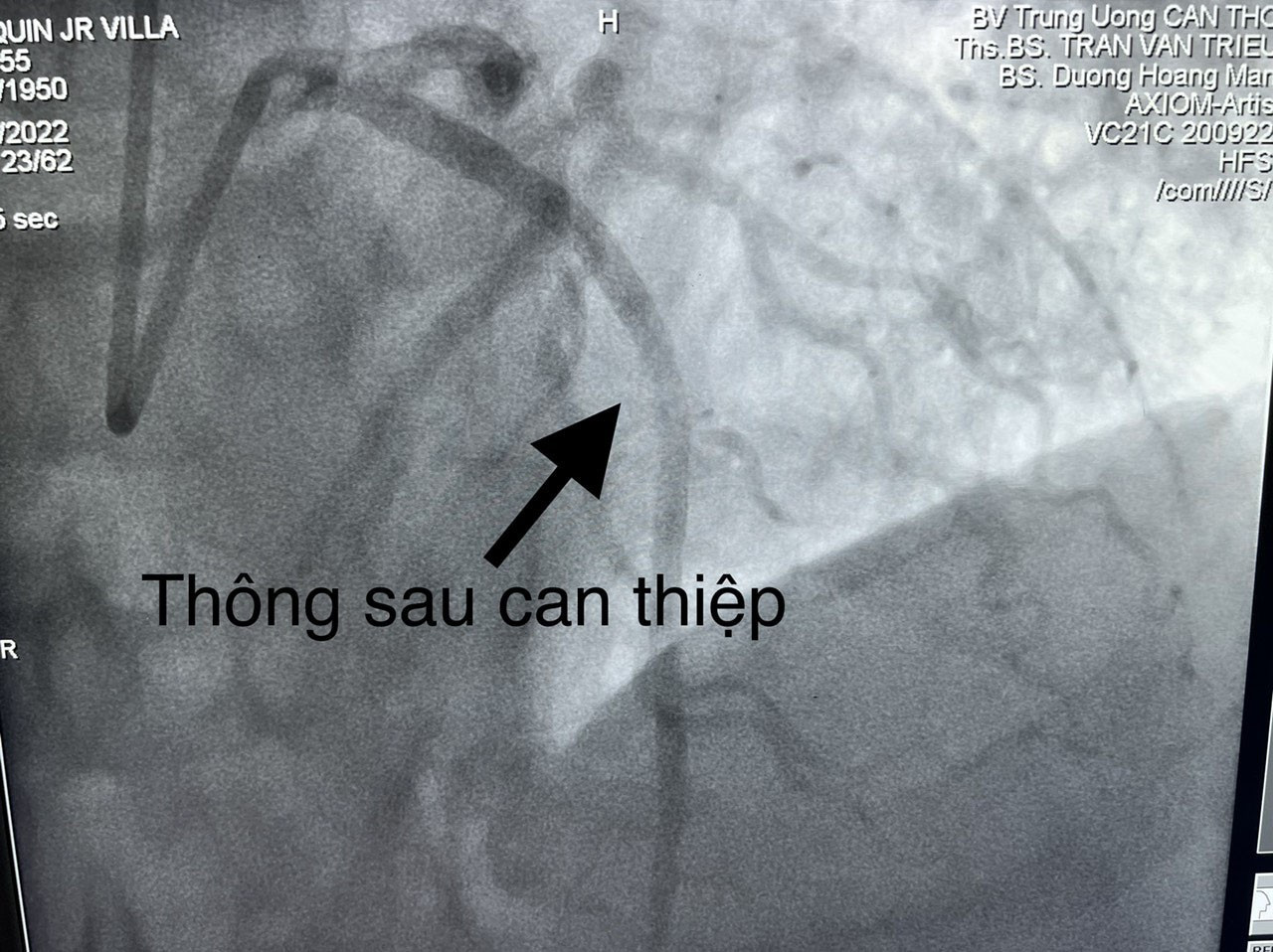 anh-03-11-1653904038.jpg