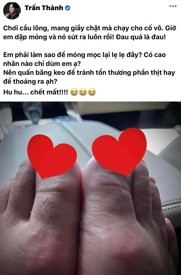 Trấn Thành đăng ảnh đôi chân bị thương, xin sự giúp đỡ của khán giả, chuyện gì đây?
