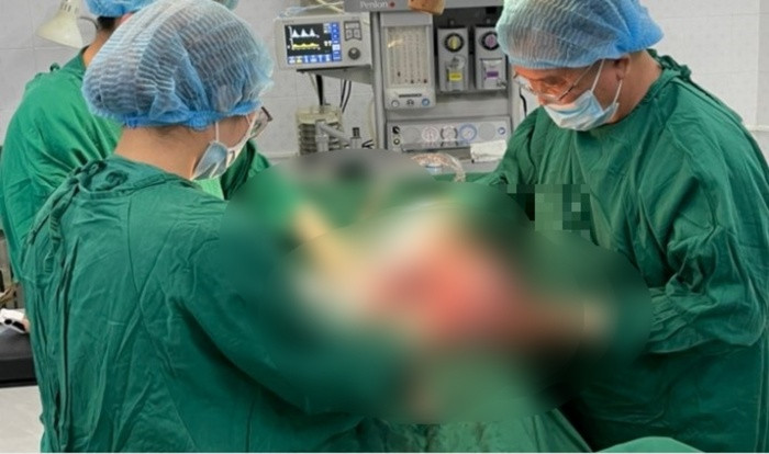 Bệnh nhân 26 tuổi được cắt khối u buồng trứng nặng 10kg Ảnh 1