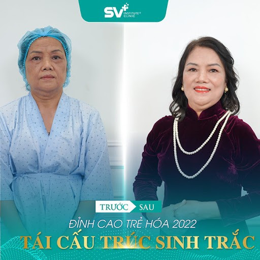 tai-cau-truc-sinh-trac-da-4-1661399672.jpg