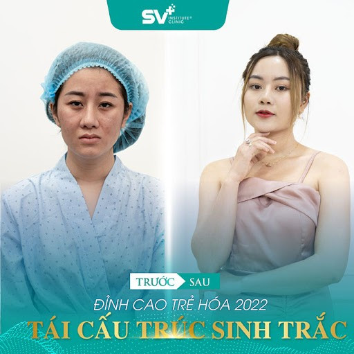tai-cau-truc-sinh-trac-da-5-1661399672.jpg