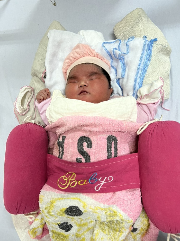Chuyện hiếm: Bé gái sơ sinh chào đời nặng 6,2kg Ảnh 2