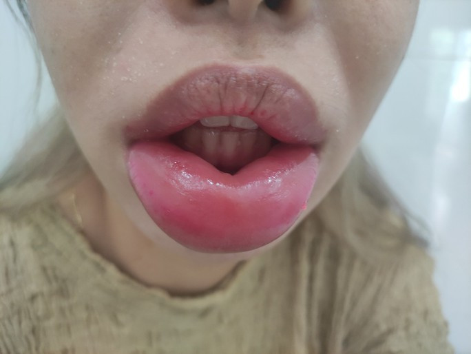 moi-1-1662709124381923498425.jpg