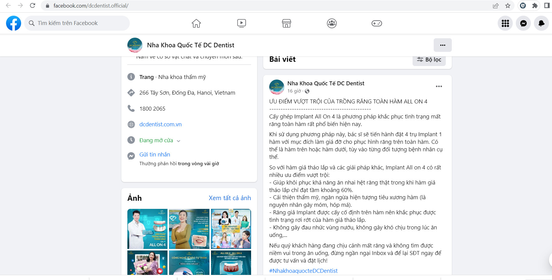 Nha khoa DC Dentist tung hô nhiều dịch vụ không được cấp phép, tiềm ẩn rủi ro cho sức khỏe, tính mạng khách hàng