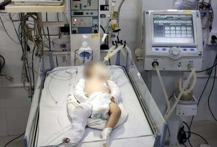 Vụ bé 3 tháng tuổi bị mẹ và nhân tình đánh chấn thương sọ não gãy xương: Lý do bé bị đánh càng phẫn nộ Ảnh 2