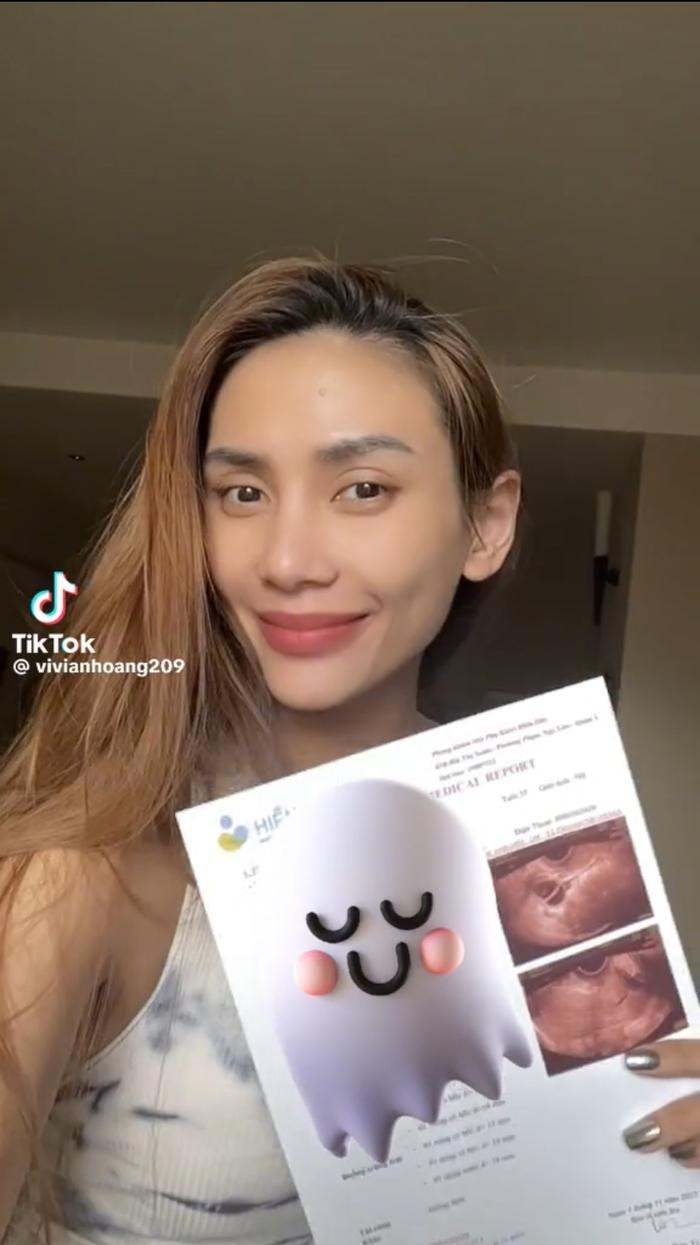 Võ Hoàng Yến trữ đông trứng, được bạn trai Việt kiều ra sức động viên Ảnh 1