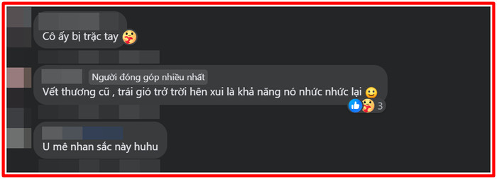 Mỹ Tâm gây xôn xao với hình ảnh bàn tay quấn băng, bị thương vì tập luyện cho đêm nhạc ở Hạ Long? Ảnh 5