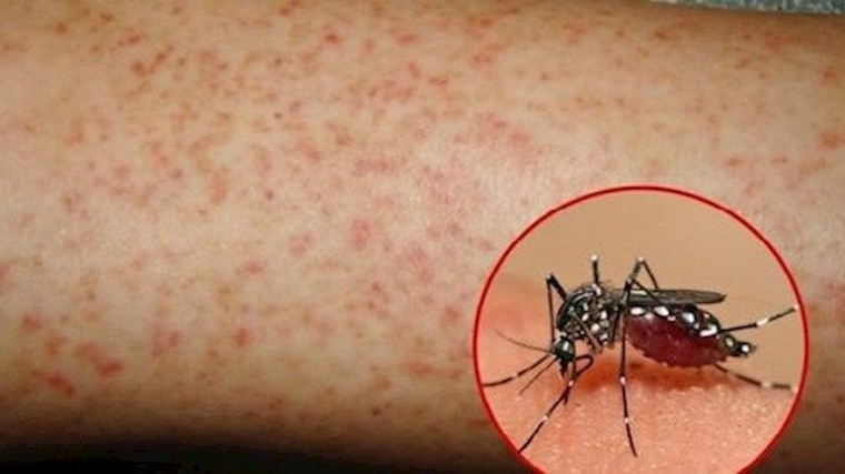Trong 7 ngày Tết Giáp Thìn, số ca khám, cấp cứu do pháo nổ tăng hơn 51% ảnh 2
