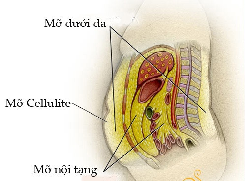Mỡ nội tạng được dự trữ trong khoang bụng Loại mỡ này tích tụ trong các động mạch làm tăng nguy mắc các bệnh về ti, mạch, nội tiết, ung thư.
