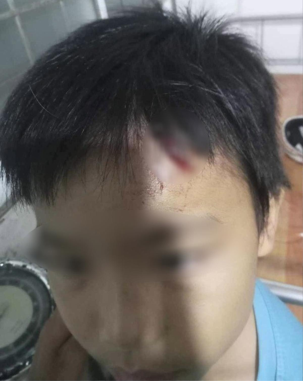 Bé trai 10 tuổi nghi bị mẹ kế tiếp tục bạo hành Ảnh 1