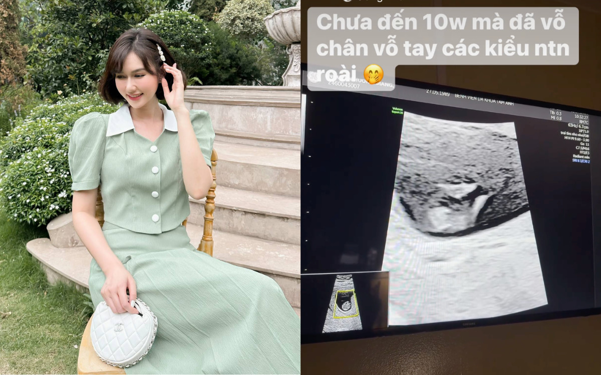 Hương Giang khoe phiếu siêu âm thai 10 tuần tuổi, xác nhận sắp làm mẹ Ảnh 1