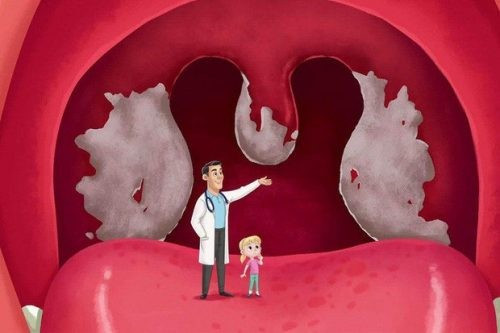 Nhóm người dễ mắc bệnh bạch hầu, nên tiêm vaccine càng sớm càng tốt