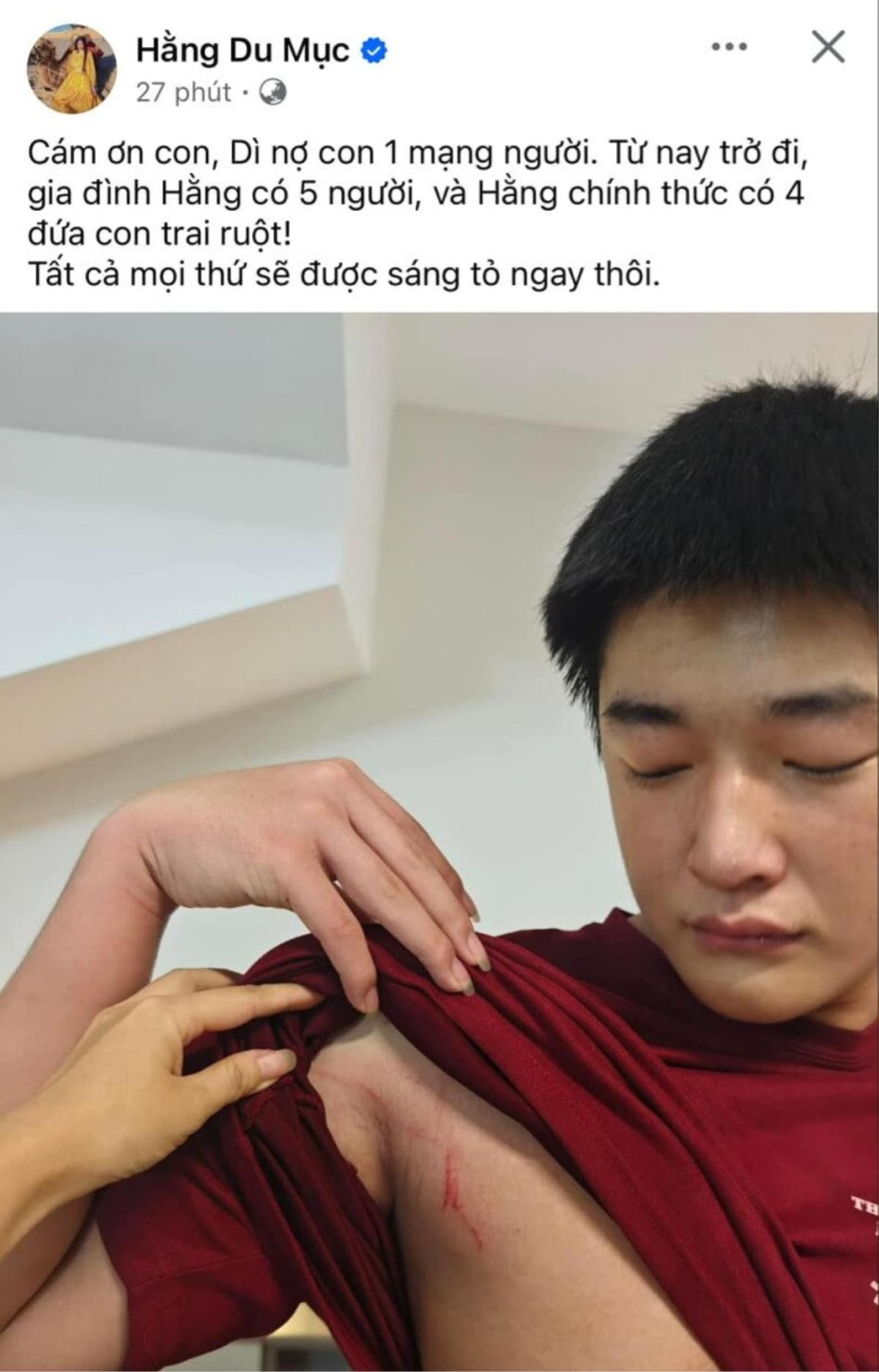 Bố ruột xác nhận Hằng Du Mục bị tác động vật lý, được con riêng của chồng bảo vệ Ảnh 3