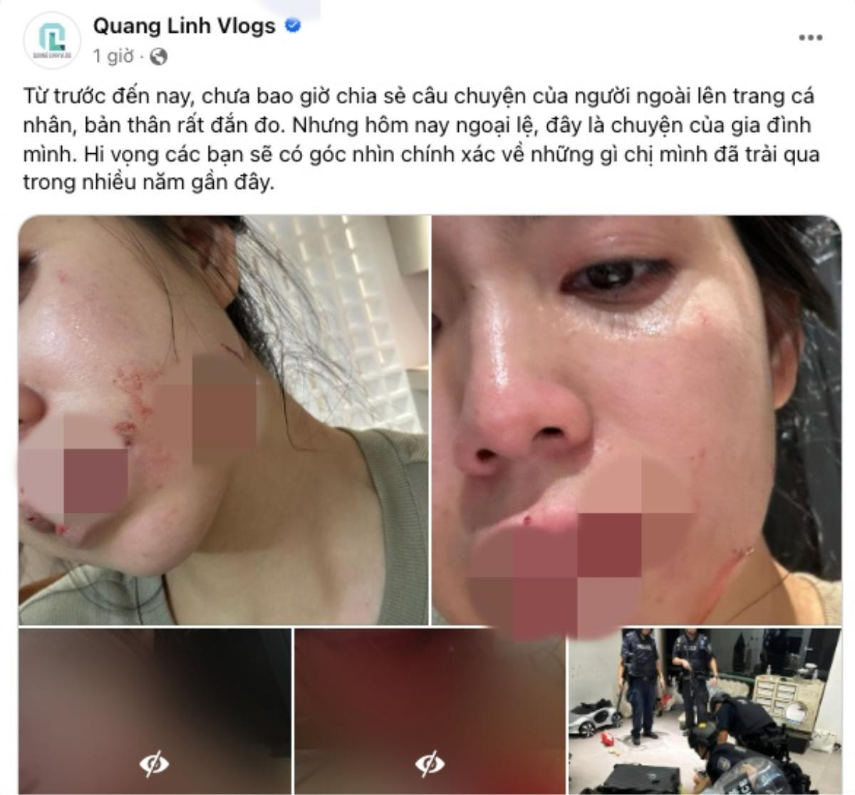 Quang Linh Vlogs đã căng trước vụ Hằng Du Mục bị chồng bạo hành Ảnh 2