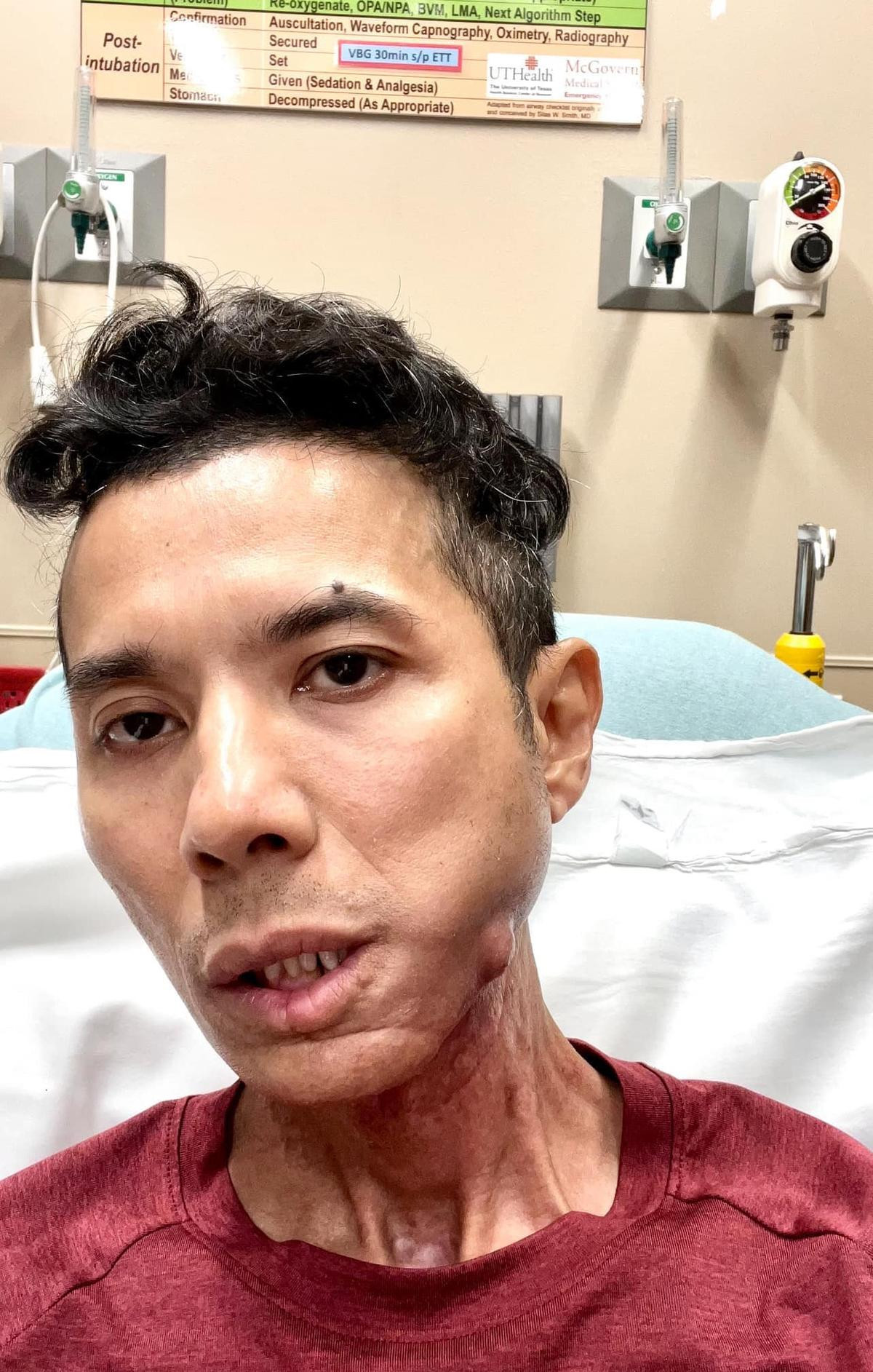 Kasim Hoàng Vũ: 'Đau không chịu nổi, mệt mỏi, run rẩy và yếu quá' Ảnh 1