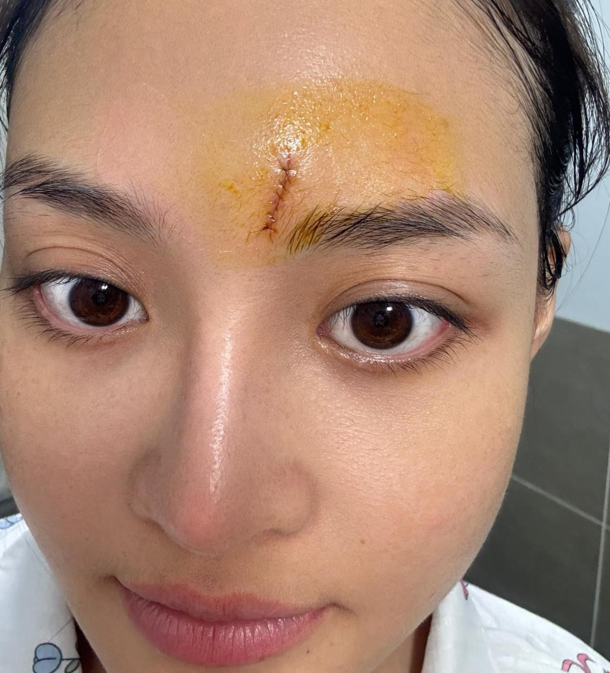 Diễn viên Thùy Anh hiện ra sao sau 1 tháng bị đòi 20 tỷ, gặp sự cố trên phim trường? Ảnh 4