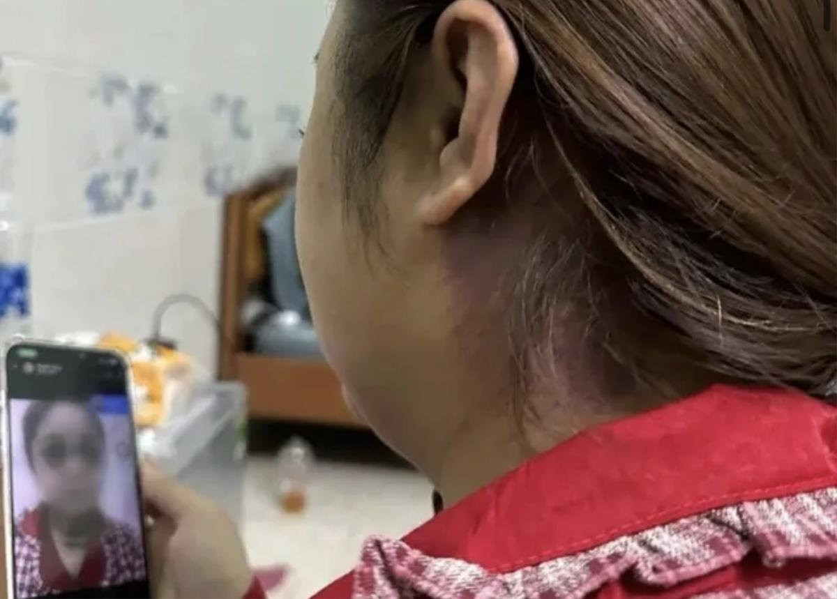Thông tin mới nhất vụ cô gái bị chồng sắp cưới bạo hành suốt 13 tiếng gây tổn thương nghiêm trọng Ảnh 1