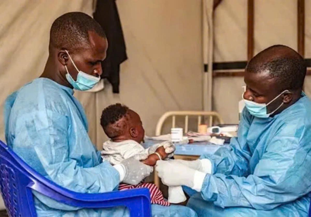 Châu Phi lại xuất hiện bệnh 'bí ẩn', khiến 300 người run rẩy mất kiểm soát Ảnh 1