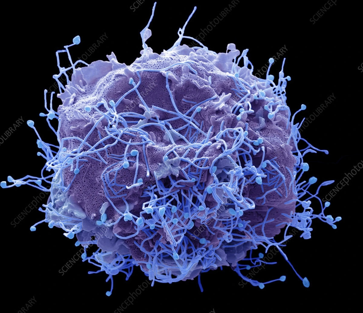 Virus HMPV gây bệnh nguy hiểm ở Trung Quốc đã lưu hành ở TPHCM Ảnh 1
