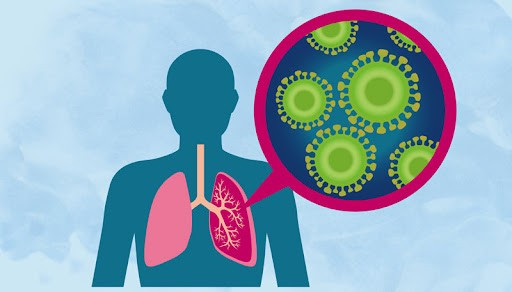 Những biến chứng nguy hiểm của bệnh cúm mùa