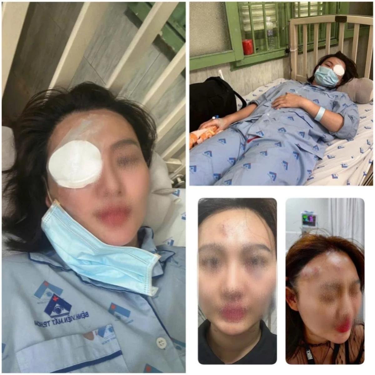Cô gái bị đánh thương tật 23%. Ảnh: PLO