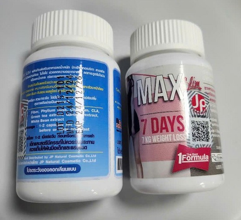 Tổn thương não sau khi dùng thuốc giảm cân mua qua mạng