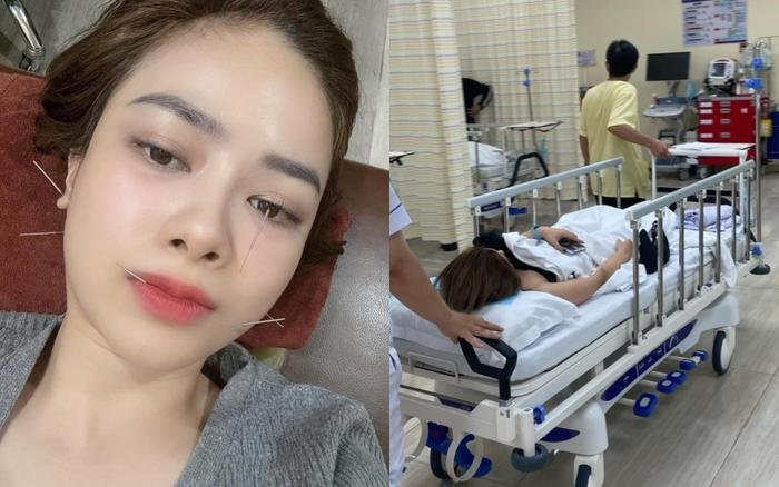 Dương Hoàng Yến được bác sĩ kết luận bị liệt dây thần kinh số 7 ngoại biên. (Ảnh: FBNV)