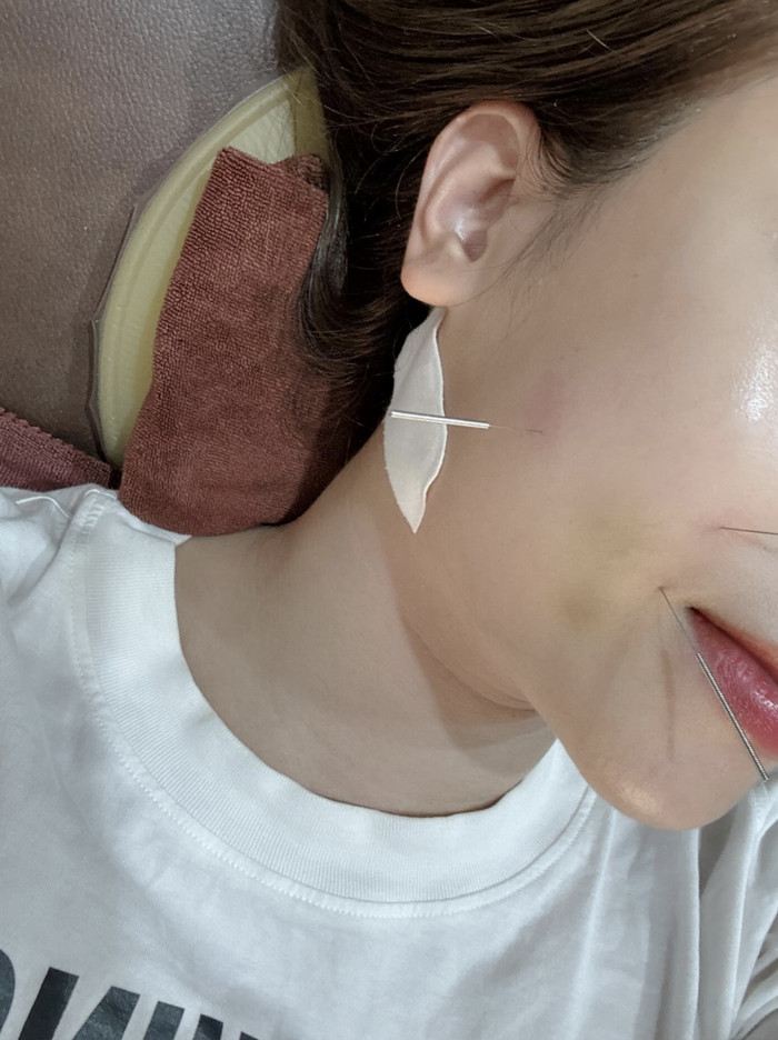Dương Hoàng Yến vừa trải qua đợt điều trị để sớm hồi phục sức khoẻ. (Ảnh: FBNV)