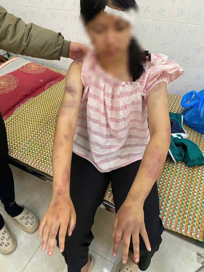 Công an Thái Nguyên thông tin vụ bé gái 13 tuổi bị ông bà đánh dã man Ảnh 2