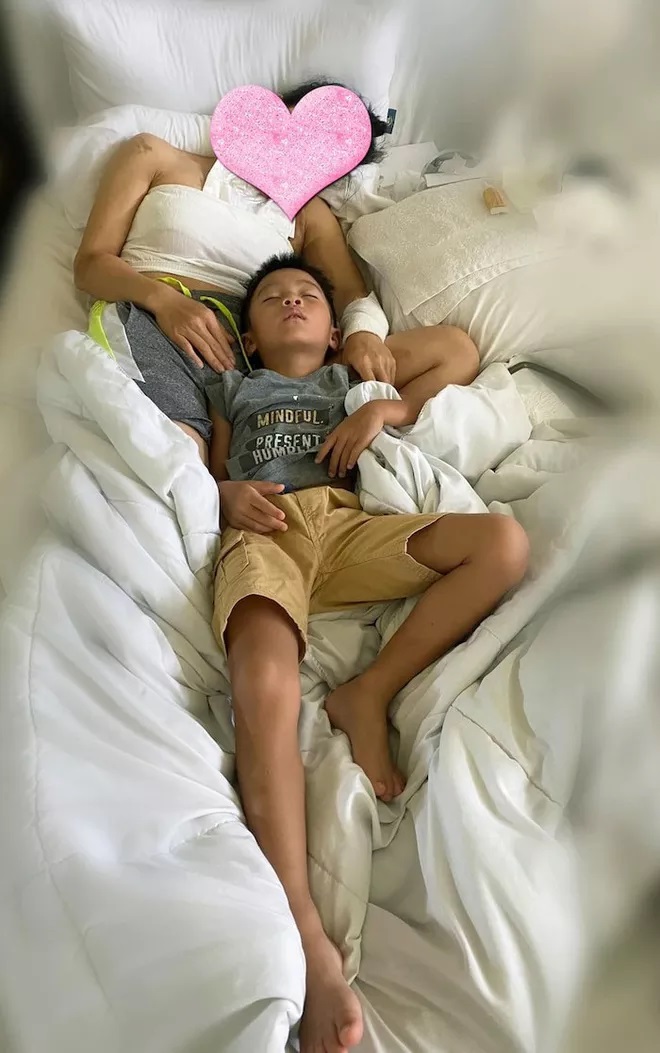 Ca sĩ Hồng Ngọc công khai khuôn mặt có phần biến dạng sau tai nạn bỏng nước sôi, dân tình không khỏi xót xa - Ảnh 2.