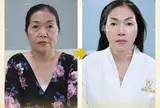 “Tam giác vàng” giúp “trẻ lại cả thập kỷ” - Khám phá 3 công nghệ thẩm mỹ được yêu thích nhất tại WangSun