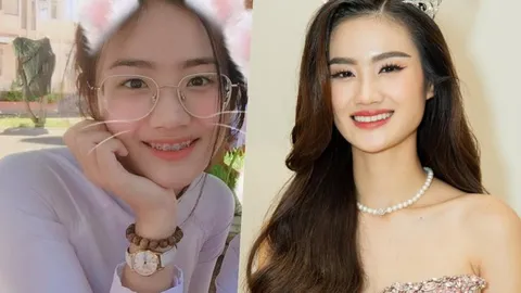 Hoa hậu Ý Nhi thăng hạng nhan sắc nhờ niềng răng