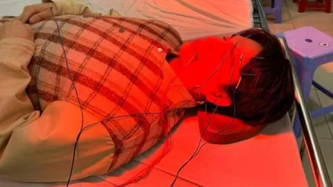 Ca sĩ Nguyễn Trần Trung Quân bị liệt nửa mặt, phải nhập viện cấp cứu