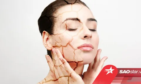 5 thành phần chăm sóc da các nàng da khô cần tránh xa