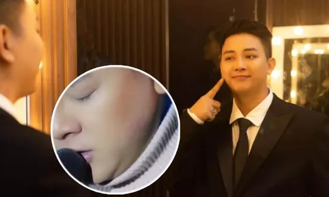 Hoài Lâm bị khán giả nữ hôn đỏ má, lên tiếng 'truy tìm' chủ nhân dấu son môi