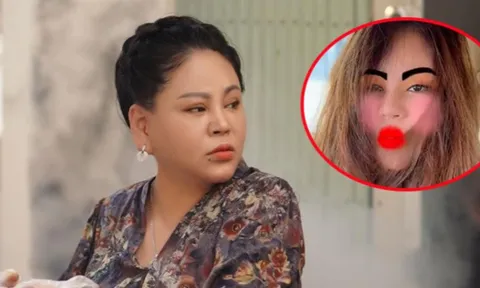 Nghệ sĩ Lê Giang xuất hiện với đôi môi sưng vù, chân mày lạ thường, chuyện gì đây?