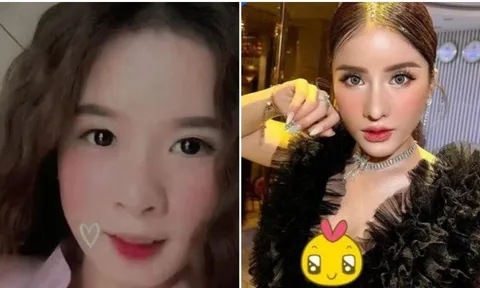 Than chịu đau kém giữa tâm drama, bà Nhân Vlog bị đào lại loạt ảnh chi vài trăm triệu sửa sang nhan sắc