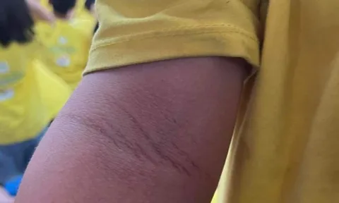 Yêu cầu dừng các khóa tu cho trẻ tại chùa Cự Đà, hoàn trả học phí sau vụ trẻ bị đánh